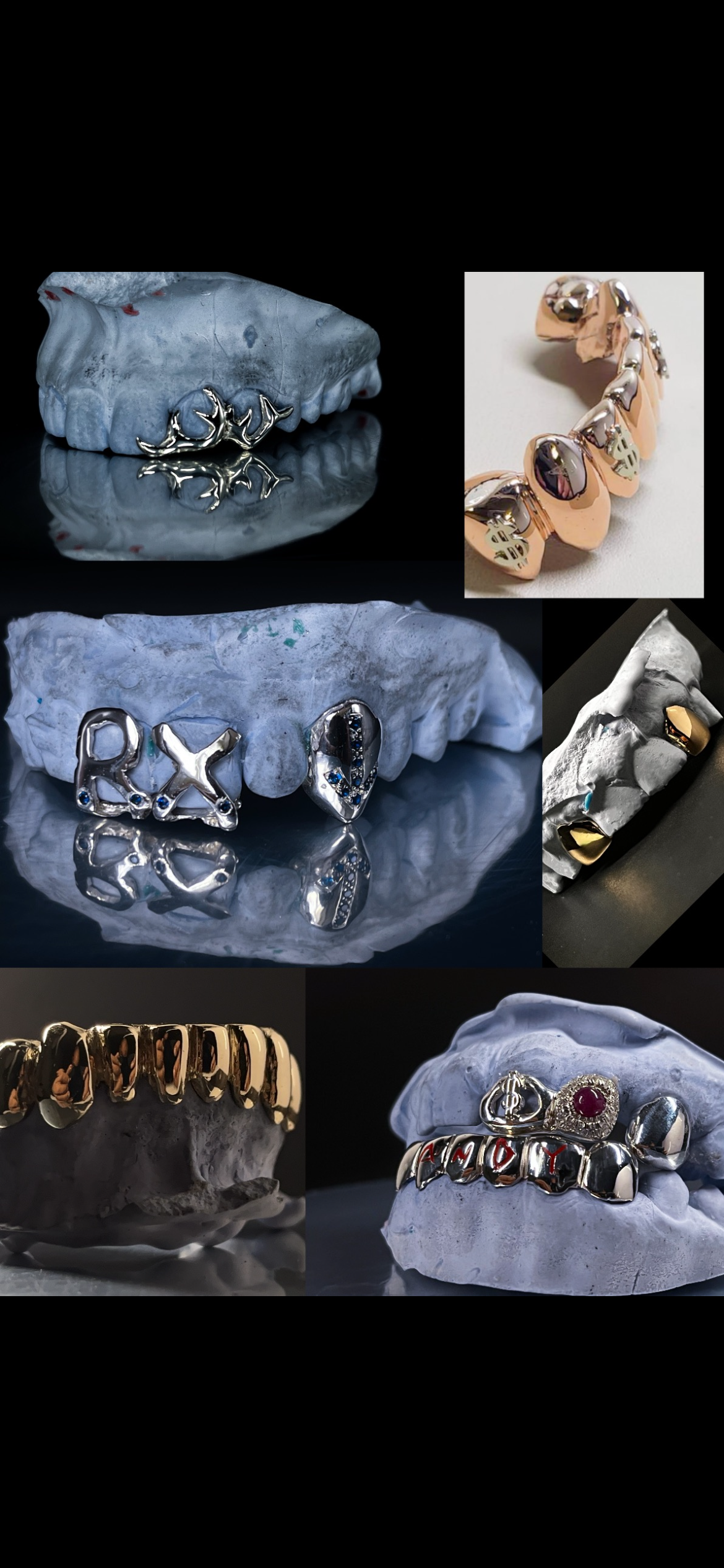 Custom grillz